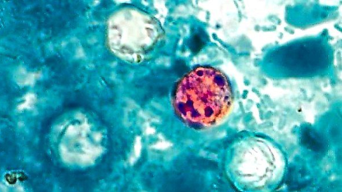 The Invisible Threat: Why Cyclospora Outbreaks Are So Hard to Stop