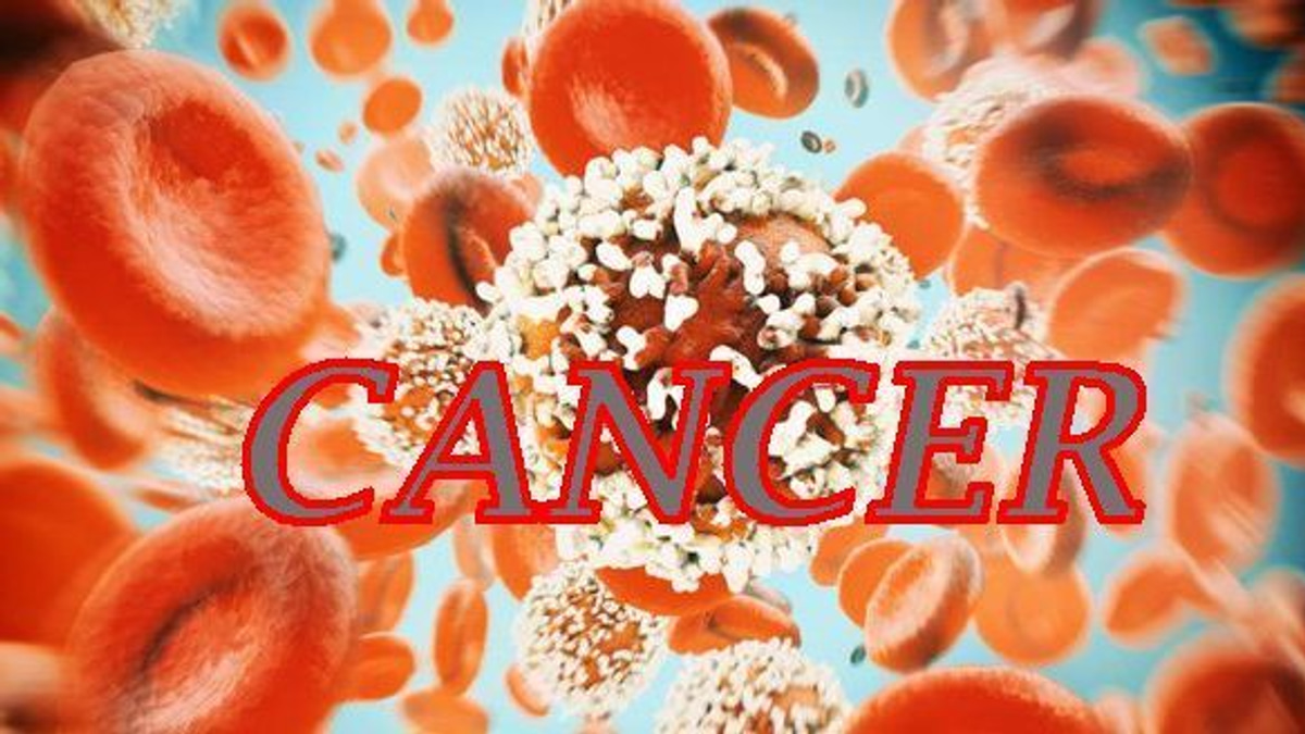 The Rising Threat of Colorectal Cancer in Young People: A Wake-Up Call for Malaysia