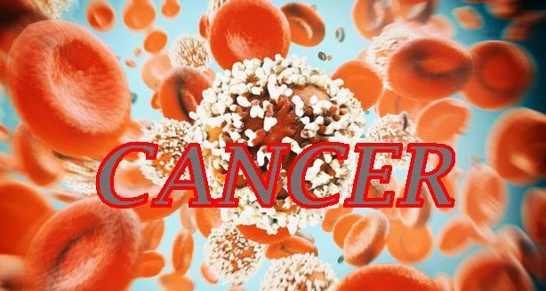 The Rising Threat of Colorectal Cancer in Young People: A Wake-Up Call for Malaysia