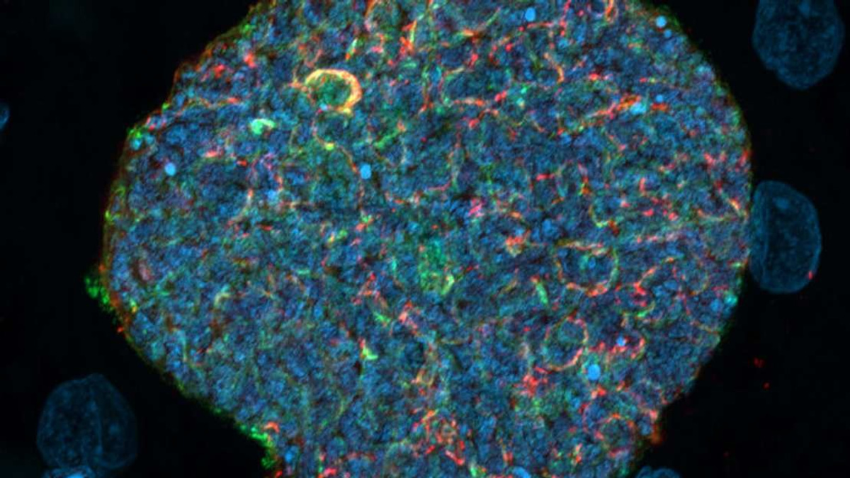 Australian Scientists Develop Malaria Vaccine Strategy Using Mosquito Bites as Natural Boosters