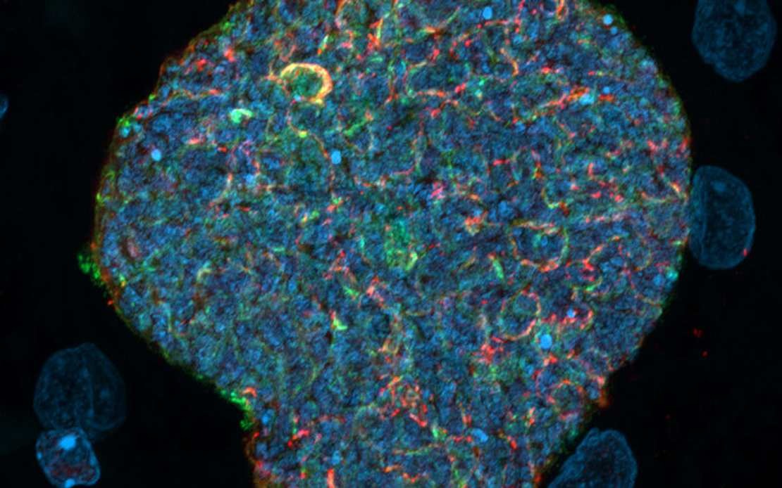 Australian Scientists Develop Malaria Vaccine Strategy Using Mosquito Bites as Natural Boosters