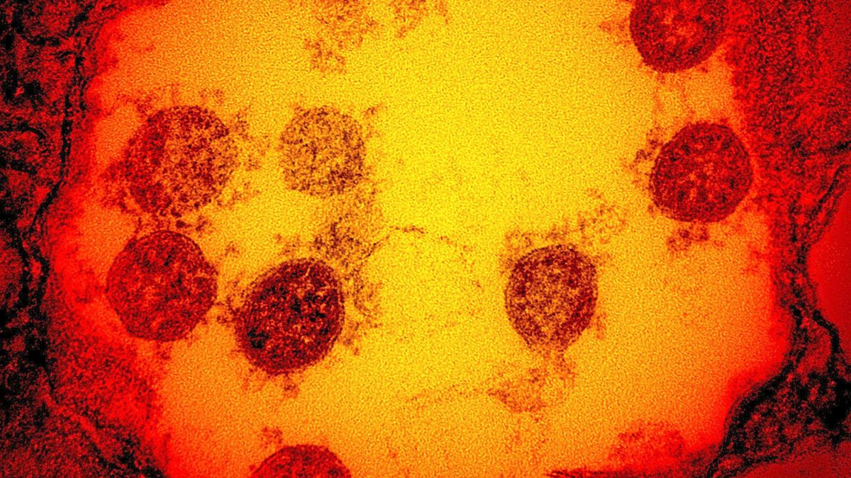 Cambridge Scientists Develop 'Master Key' Vaccine Technology Using AI to Target Virus Families