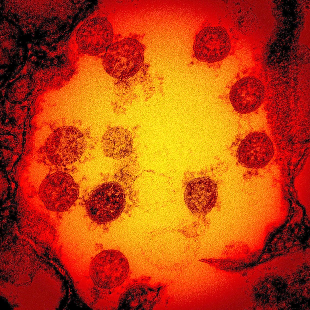 Cambridge Scientists Develop 'Master Key' Vaccine Technology Using AI to Target Virus Families
